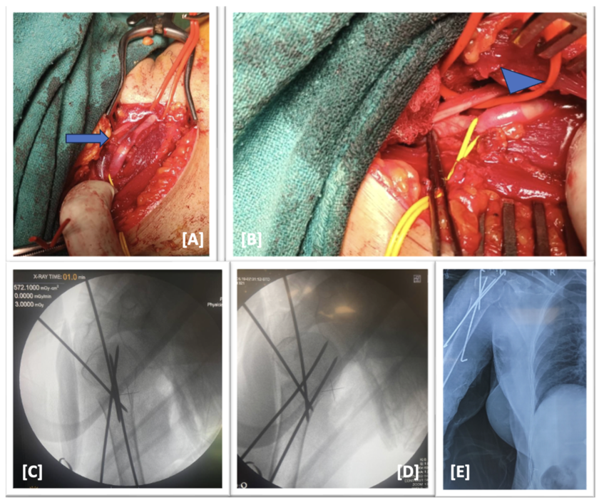 When a Simple Fall Isn’t So Simple feature image